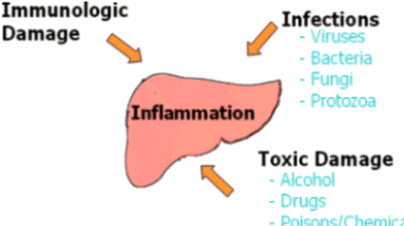 Patients in whom a diagnosis of autoimmune hepatitis 