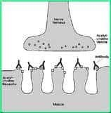 Myasthenia