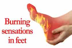 burning feet