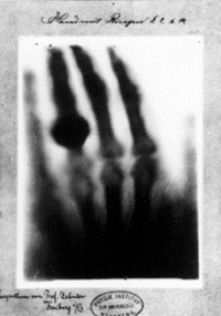 Roentgen's wife's hand.
