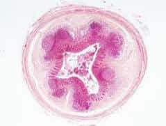 Appendis Histology