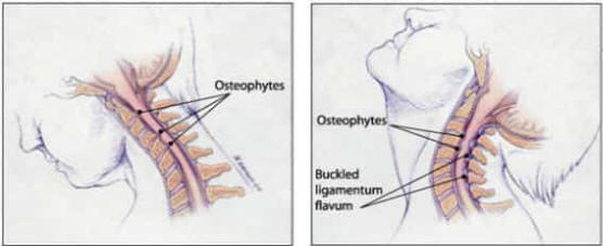 Cervical spine