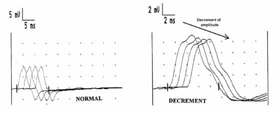 CMAP decrement