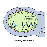 Kidney Filter Unit showing Immune Complex