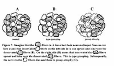 Muscle Fibers