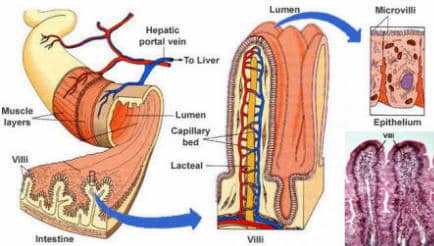 Celiac disease villie 