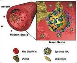 Cholesterol