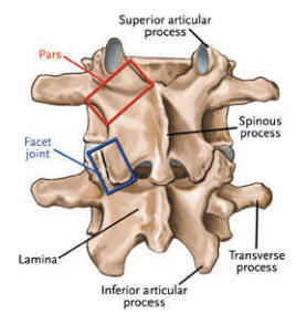 Steroid arthropathy shoulder