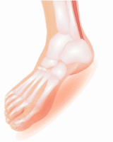 BURNING FEET