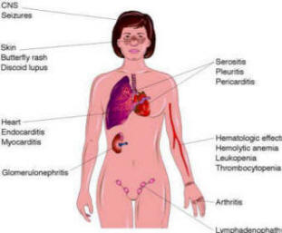 Steroids used for joint pain