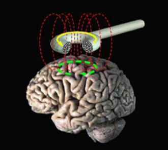 Eddy Current Brain Stimulation